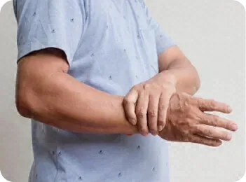 Dermatomyositis - Arthritis Medical Clinic