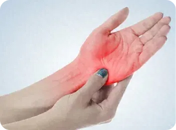 Rheumatoid Arthritis - Arthritis Medical Clinic